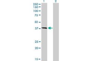 Western Blot analysis of HFE expression in transfected 293T cell line by HFE monoclonal antibody (M01), clone 1G12. (HFE 抗体  (AA 115-205))
