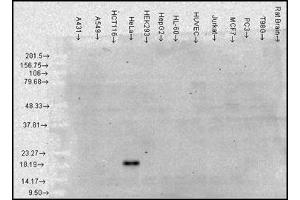 Western blot of Alpha B Crystallin (CRYAB ELISA 试剂盒)