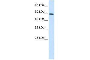 WB Suggested Anti-TBC1D10B Antibody Titration:  1. (TBC1D10B 抗体  (C-Term))