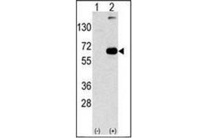 Western blot analysis of SQSTM1 (arrow) using SQSTM1 Antibody . (SQSTM1 抗体  (C-Term))