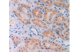 IHC-P analysis of kidney tissue, with DAB staining. (CUBN 抗体  (AA 3511-3623))