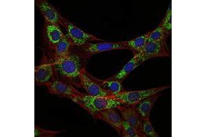 Immunofluorescence analysis of 3T3-L1 cells using EEF2 mouse mAb (green). (EEF2 抗体)