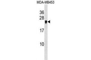 CRIP2 Antibody (C-term) western blot analysis in MDA-MB453 cell line lysates (35µg/lane). (CRIP2 抗体  (C-Term))