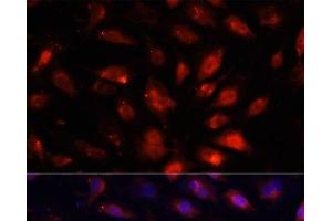 Immunofluorescence analysis of NIH/3T3 cells using ENO3 Polyclonal Antibody at dilution of 1:100. (ENO3 抗体)