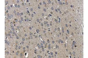 ABIN6257674 and ABIN6275488 at 1/100 staining rat brain tissue by IHC-P. (ARHGDIG 抗体  (Internal Region))