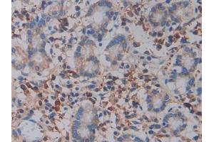 Detection of ITGb3 in Human Stomach Tissue using Polyclonal Antibody to Integrin Beta 3 (ITGb3) (Integrin beta 3 抗体  (AA 135-377))