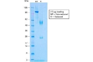 SDS-PAGE Analysis Purified TNF alpha Rabbit Recombinant Monoclonal Antibody (TNF/1500R). (Recombinant TNF alpha 抗体)