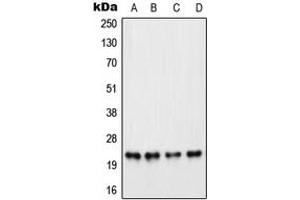 Western blot analysis of PARP1 expression in HeLa PMA-treated (A), Raw264. (PARP1 抗体  (Center))