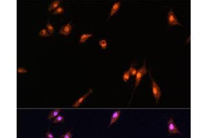 Immunofluorescence analysis of L929 cells using YAP1 Polyclonal Antibody at dilution of 1:100. (YAP1 抗体)