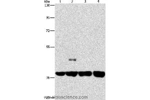 Western blot analysis of 293T and 231 cell, U937 and Raji cell, using SERPINA9 Polyclonal Antibody at dilution of 1:350 (SERPINA9 抗体)