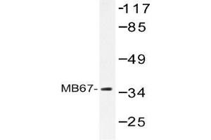 Western blot (WB) analysis of MB67 antibody in extracts from Jurkat cells. (NR1I3 抗体)