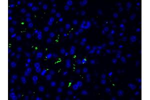 ABIN6261455 and ABIN6277691 at 1/200 staining human liver tissue cells by ICC/IF.