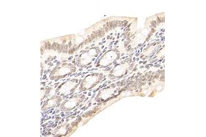 Immunohistochemistry of paraffin embedded rat colon using USP13 (ABIN7076106) at dilution of 1:700 (400x lens) (USP13 抗体)