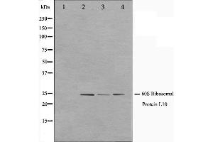 Western blot analysis on K562,Jurkat and 293 cell lysate using RPL10 Antibody. (RPL10 抗体  (N-Term))