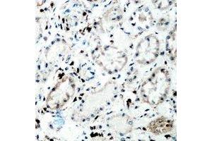 Immunohistochemical analysis of Tenascin C staining in human kidney formalin fixed paraffin embedded tissue section.