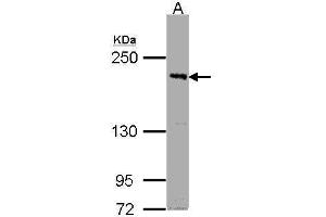 WB Image Sample (30μg whole cell lysate) A:Raji , 5% SDS PAGE antibody diluted at 1:1000 (PASK 抗体  (C-Term))