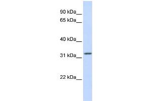 WB Suggested Anti-APTX Antibody Titration:  0. (Aprataxin 抗体  (Middle Region))