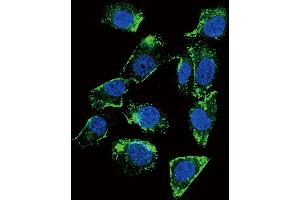 Confocal immunofluorescent analysis of BTC Antibody (N-term) (ABIN655615 and ABIN2845096) with MDA-M cell followed by Alexa Fluor 488-conjugated goat anti-rabbit lgG (green). (Betacellulin 抗体  (N-Term))