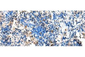 Immunohistochemistry (Paraffin-embedded Sections) (IHC (p)) image for anti-Nudix (Nucleoside Diphosphate Linked Moiety X)-Type Motif 10 (NUDT10) antibody (ABIN7245821)