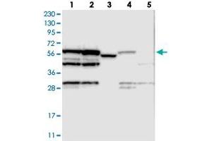 Western blot analysis of Lane 1: RT-4, Lane 2: U-251 MG, Lane 3: Human Plasma, Lane 4: Liver, Lane 5: Tonsil with MPP6 polyclonal antibody . (MPP6 抗体)