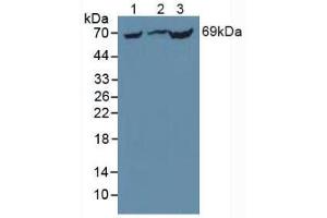 Western blot analysis of (1) Mouse Liver Tissue, (2) Rat Liver Tissue and (3) Mouse Kidney Tissue. (PCK1 抗体  (AA 312-563))