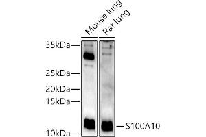Western blot analysis of extracts of various cell lines, using S100 antibody (ABIN3015803, ABIN3015804, ABIN3015805, ABIN1682607 and ABIN6219148) at 1:400 dilution. (S100A10 抗体  (AA 1-97))