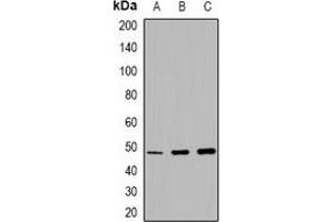 Western blot analysis of MMP13 expression in DLD1 (A), rat lung (B), rat testis (C) whole cell lysates. (MMP13 抗体)