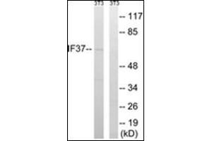 Western blot analysis of extracts from NIH-3T3 cells, using EIF3D Antibody. (EIF3D 抗体)