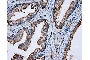 Immunohistochemical staining of paraffin-embedded prostate tissue using anti-PRKAR2A mouse monoclonal antibody. (PRKAR2A 抗体)