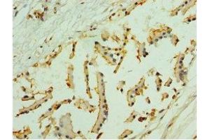 Immunohistochemistry of paraffin-embedded human prostate tissue using ABIN7161326 at dilution of 1:100 (Neuroligin Y 抗体  (AA 682-816))