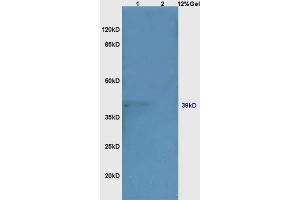 Lane 1: mouse kidney lysates Lane 2: mouse embryo lysates probed with Anti GRM1 Polyclonal Antibody, Unconjugated (ABIN687652) at 1:200 in 4 °C. (NEUROD1 抗体  (AA 21-120))