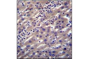Immunohistochemistry analysis in Formalin Fixed, Paraffin Embedded Human liver tissue stained with SCP2 Antibody (N-term) followed by peroxidase conjugation of the secondary antibody and DAB staining. (SCP2 抗体  (N-Term))