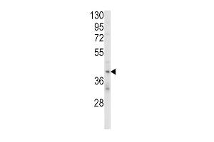 Western blot analysis of KIR2DL4 Antibody (C-term) (ABIN652985 and ABIN2842625) in MDA-M cell line lysates (35 μg/lane). (KIR2DL4/CD158d 抗体  (C-Term))