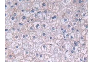 Immunohistochemistry (IHC) image for anti-Fatty Acid Desaturase 2 (FADS2) (AA 1-130) antibody (ABIN7436027)