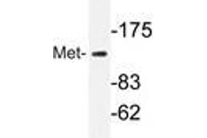 Western blot analyzes of Met antibody in extracts from HepG2 cells. (c-MET 抗体)