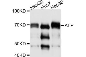 Western blot analysis of extracts of various cell lines, using AFP antibody (ABIN4902853). (alpha Fetoprotein 抗体)