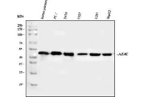 Western blot analysis of ADK using anti-ADK antibody (ABIN4886430). (ADK 抗体  (AA 165-351))