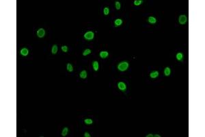 Immunofluorescence staining of Hela cells (treated with 30mM sodium butyrate for 4h) with ABIN7139198 at 1:5, counter-stained with DAPI. (HIST1H4A 抗体  (acLys79))