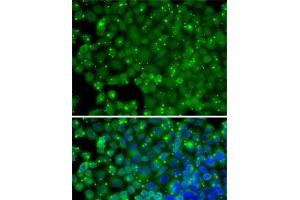 Immunofluorescence analysis of HeLa cells using ARRB2 Polyclonal Antibody (Arrestin 3 抗体)