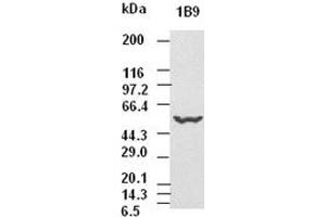 CK8 antibody (1B9) at 1:5000 dilution + Hela cell lysate (KRT8 抗体  (AA 91-381))