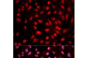 Immunofluorescence analysis of MCF-7 cells using Phospho-Dnmt1(pY399) Polyclonal Antibody (DNMT1 抗体  (pTyr399))