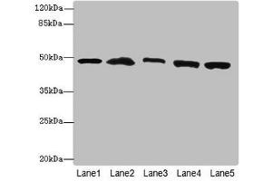 Western Blotting (WB) image for anti-Proteasome (Prosome, Macropain) 26S Subunit, Non-ATPase, 13 (PSMD13) (AA 1-250), (Regulatory Subunit 13) antibody (ABIN7142207)