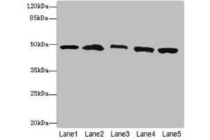 Western blot All lanes: PSMD13antibody at 3. (PSMD13 抗体  (Regulatory Subunit 13))