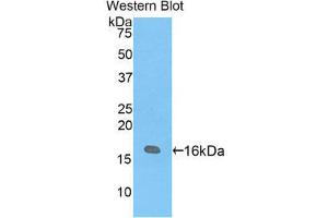 Western Blotting (WB) image for anti-Vasoactive Intestinal Peptide (Vip) (AA 34-157) antibody (ABIN1860940) (Vip 抗体  (AA 34-157))