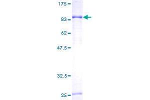 Phosphoglucomutase 3 Protein (PGM3) (AA 1-542) (GST tag)