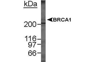 Western blot analysis of BRCA1 in MCF-7 whole cell lysate using BRCA1 monoclonal antibody, clone MU . (BRCA1 抗体  (AA 1314-1864))