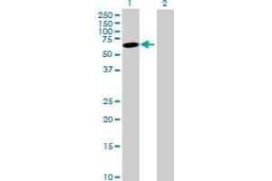 Western Blot analysis of JRK expression in transfected 293T cell line by JRK MaxPab polyclonal antibody. (JRK 抗体  (AA 1-568))
