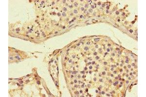 Immunohistochemistry of paraffin-embedded human testis tissue using ABIN7143303 at dilution of 1:100