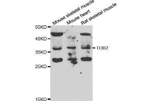 Western blot analysis of extracts of various cell lines, using TOB2 antibody. (TOB2 抗体)