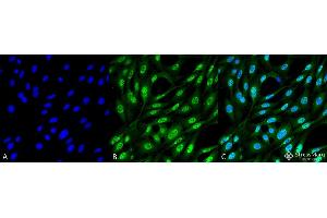 Immunocytochemistry/Immunofluorescence analysis using Mouse Anti-Ubiquitin Monoclonal Antibody, Clone FK2 . (Ubiquitin 抗体  (HRP))